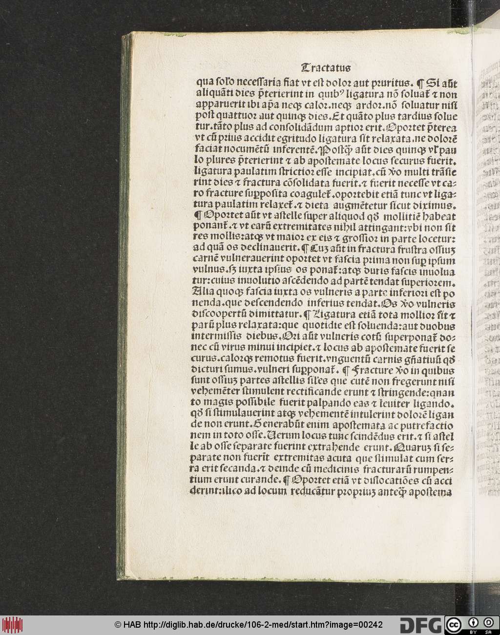 http://diglib.hab.de/drucke/106-2-med/00242.jpg