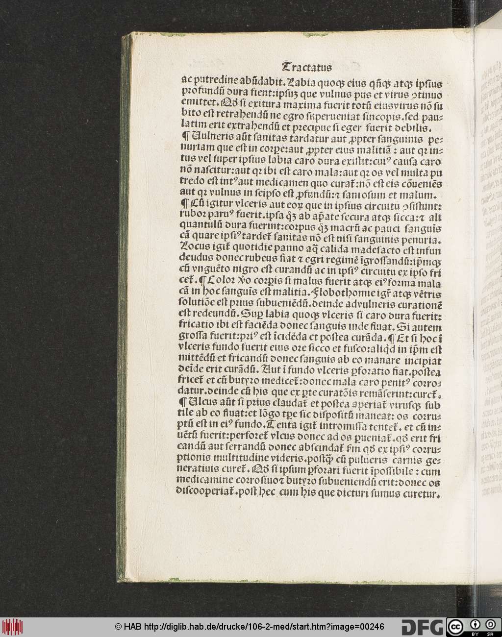 http://diglib.hab.de/drucke/106-2-med/00246.jpg