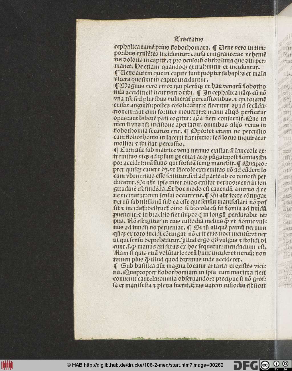 http://diglib.hab.de/drucke/106-2-med/00262.jpg