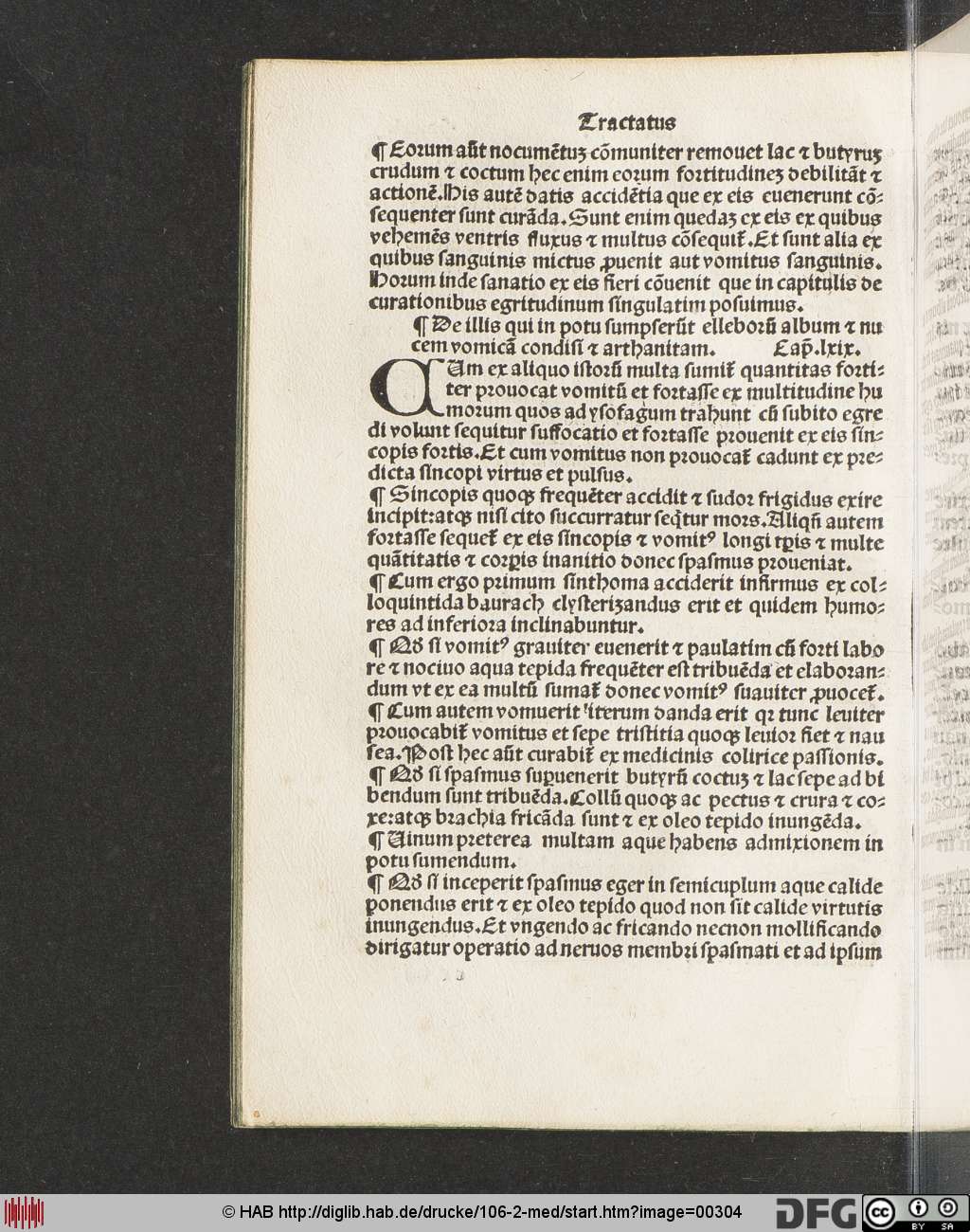 http://diglib.hab.de/drucke/106-2-med/00304.jpg