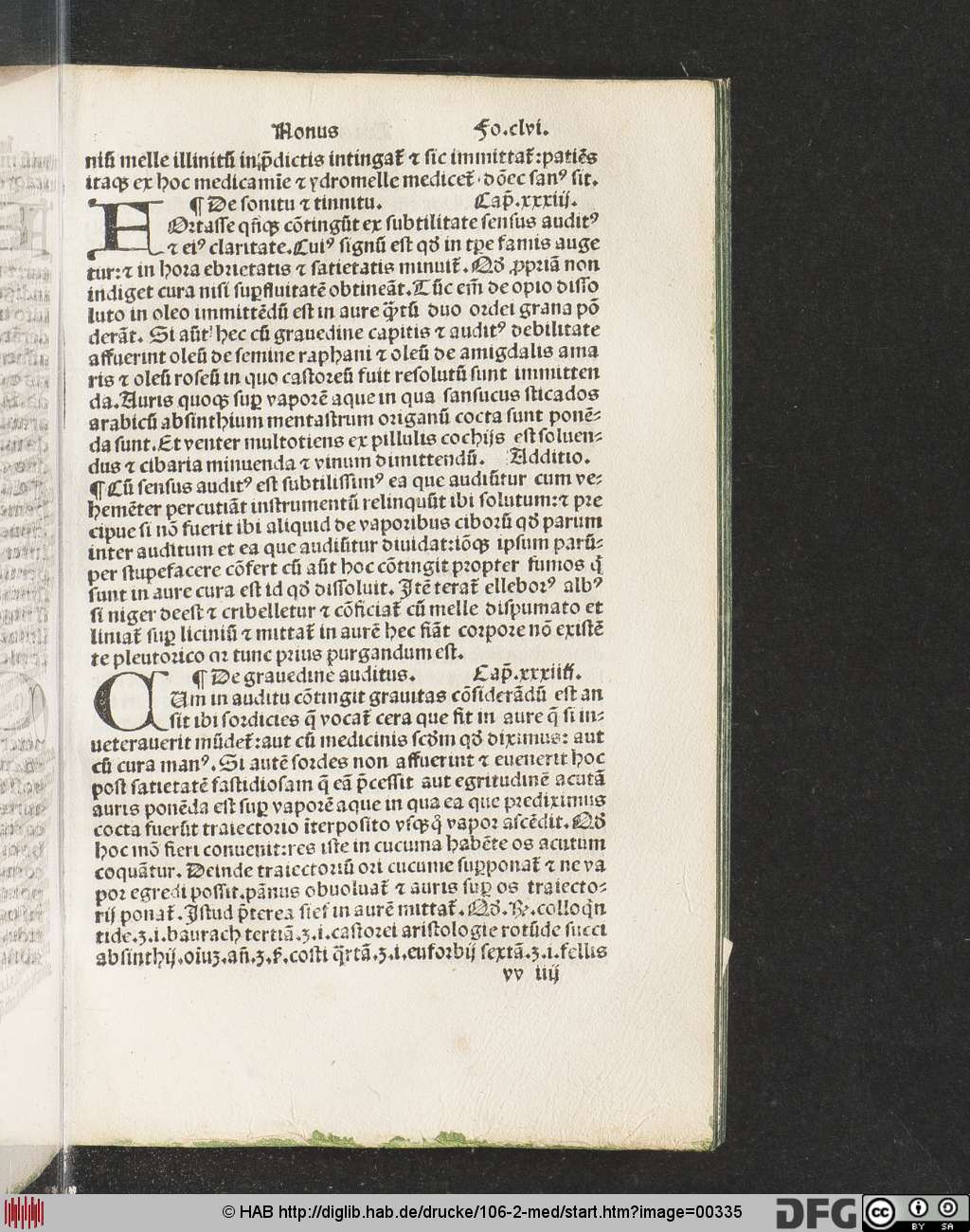 http://diglib.hab.de/drucke/106-2-med/00335.jpg