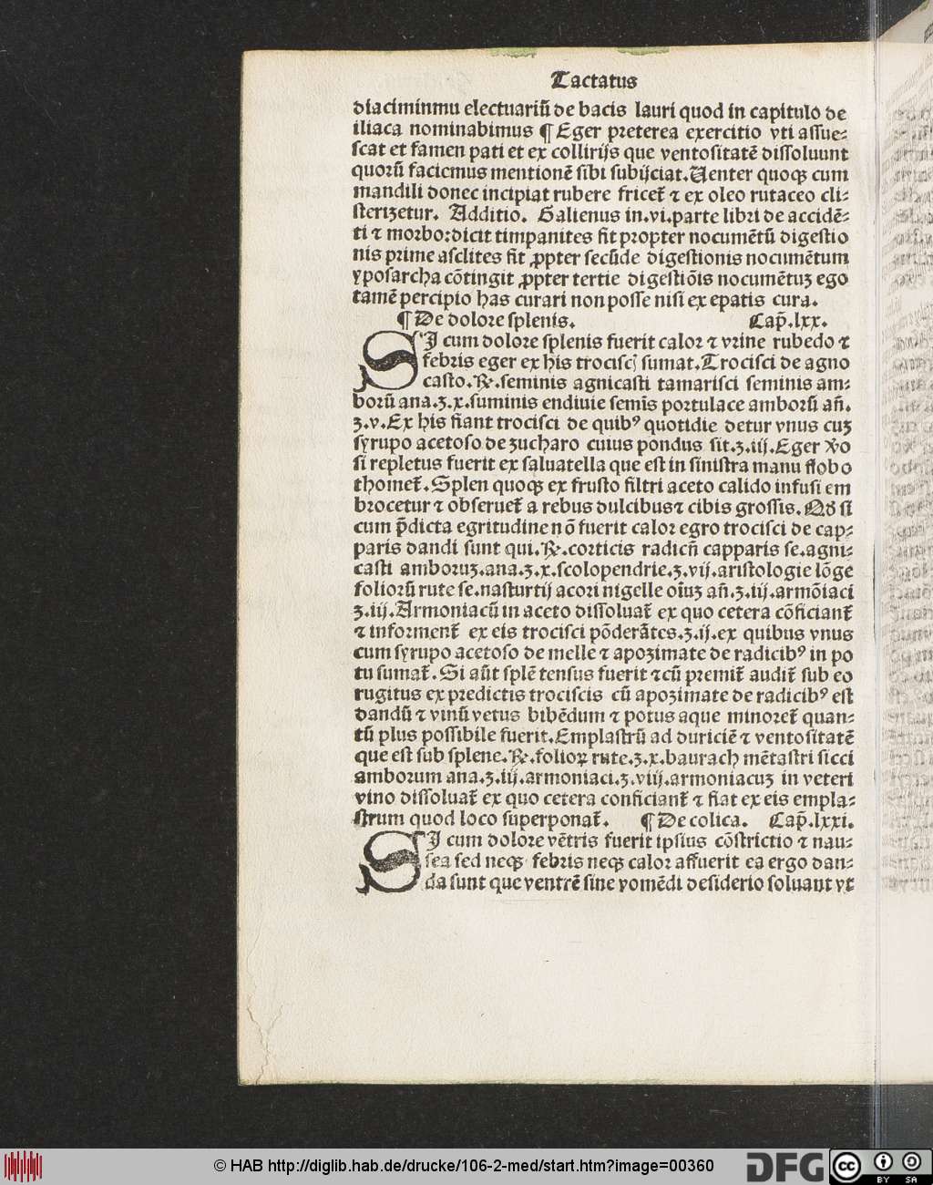http://diglib.hab.de/drucke/106-2-med/00360.jpg