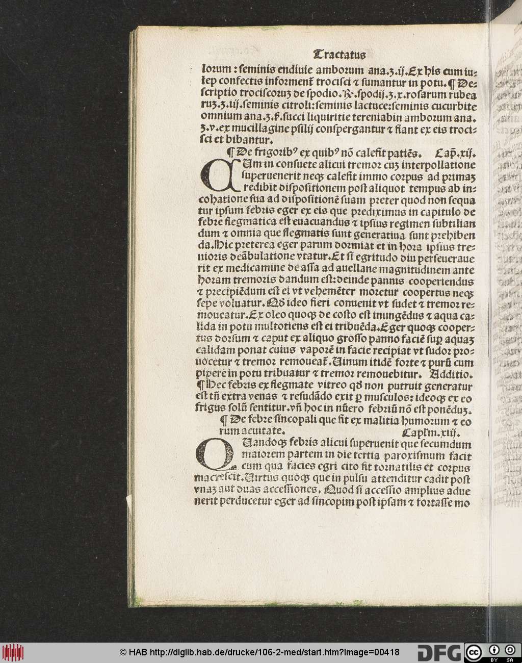 http://diglib.hab.de/drucke/106-2-med/00418.jpg