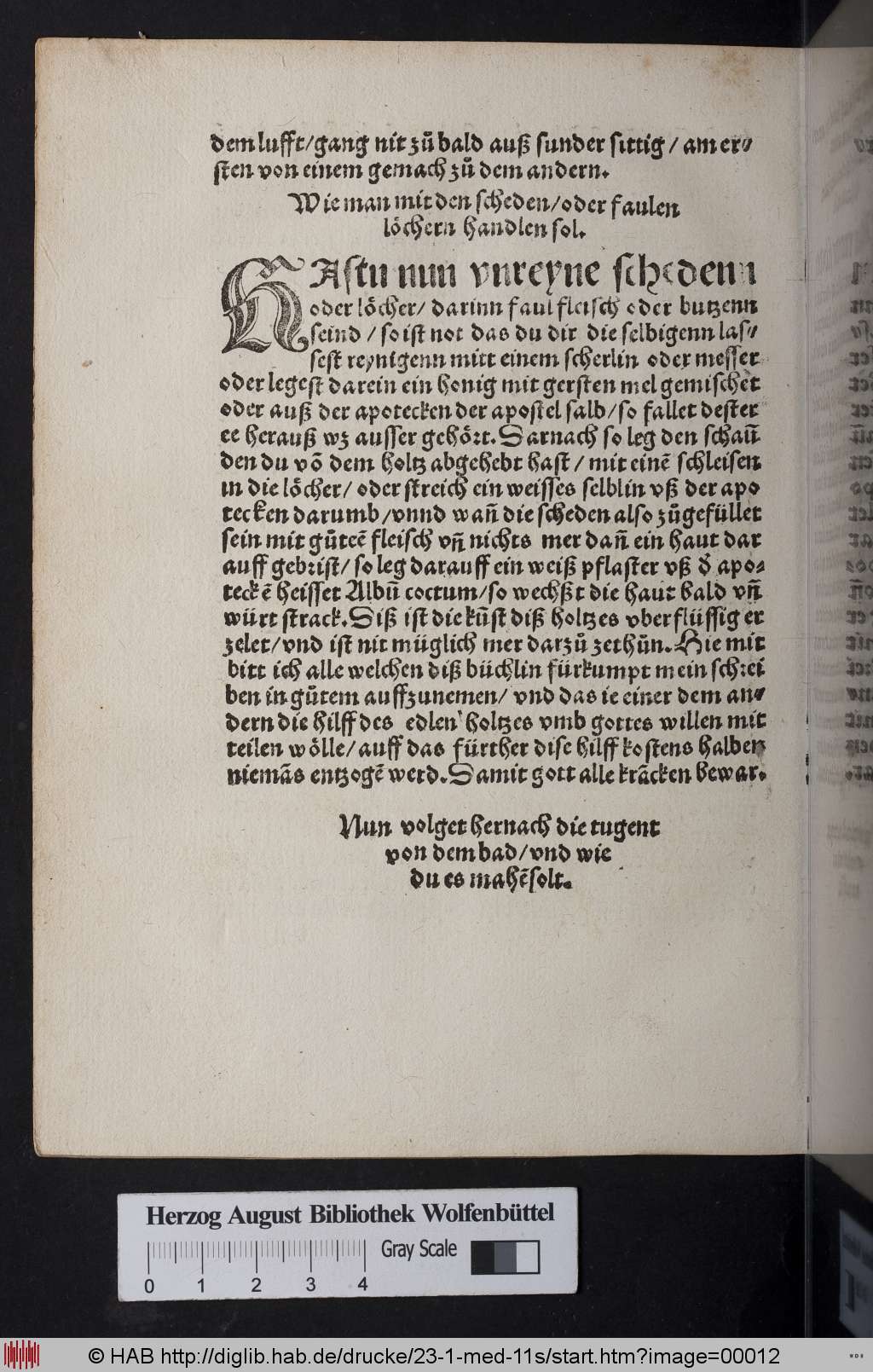 http://diglib.hab.de/drucke/23-1-med-11s/00012.jpg