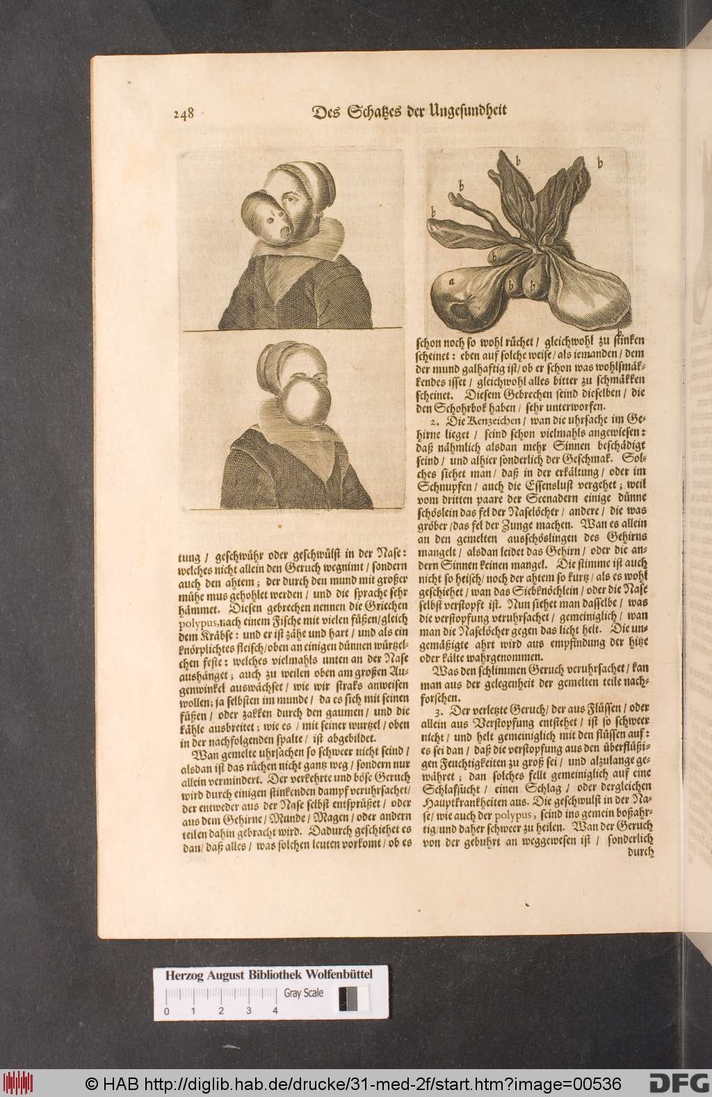 http://diglib.hab.de/drucke/31-med-2f/00536.jpg