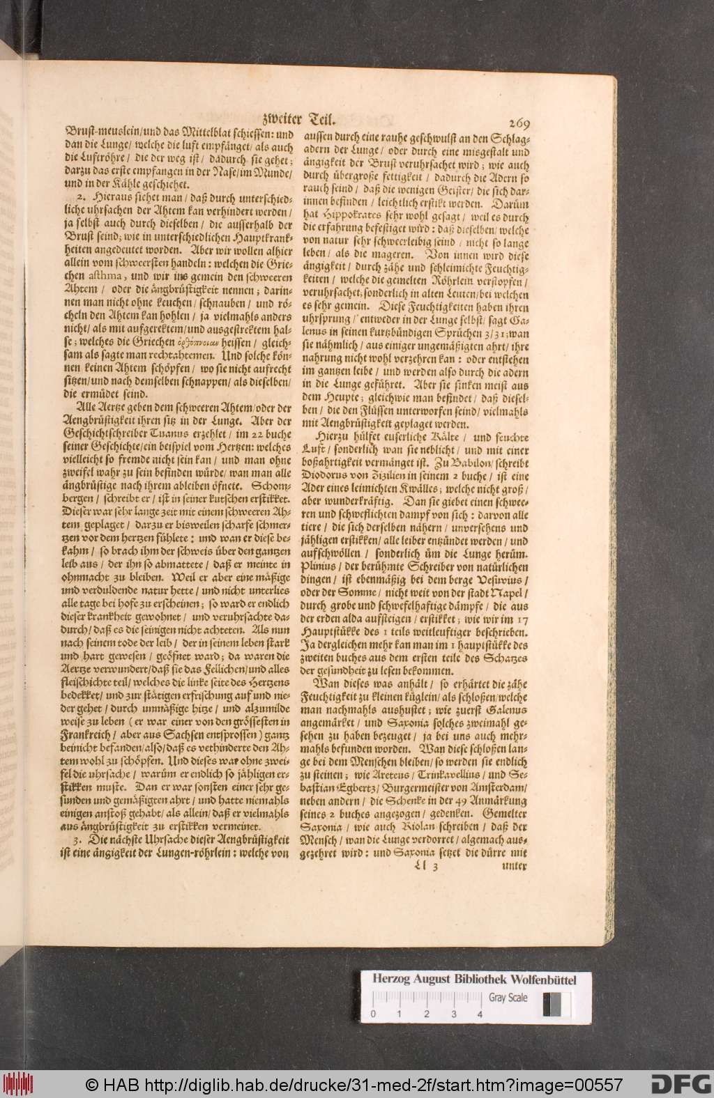 http://diglib.hab.de/drucke/31-med-2f/00557.jpg