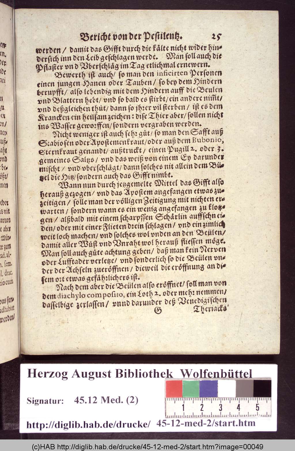 http://diglib.hab.de/drucke/45-12-med-2/00049.jpg