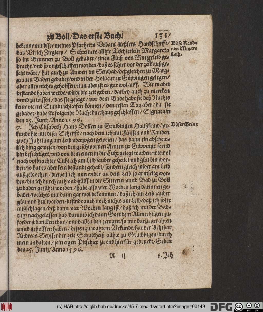 http://diglib.hab.de/drucke/45-7-med-1s/00149.jpg