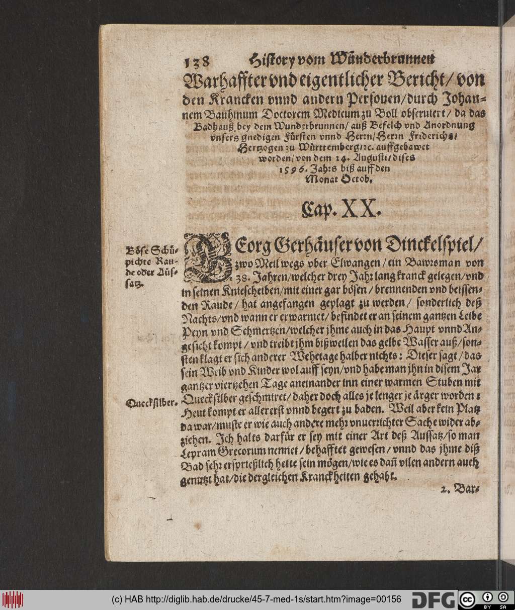 http://diglib.hab.de/drucke/45-7-med-1s/00156.jpg