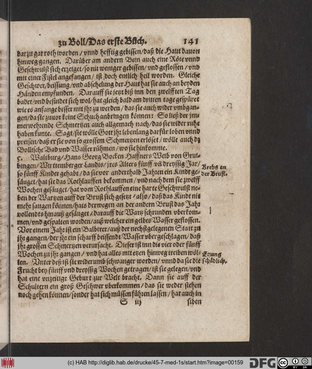 http://diglib.hab.de/drucke/45-7-med-1s/00159.jpg