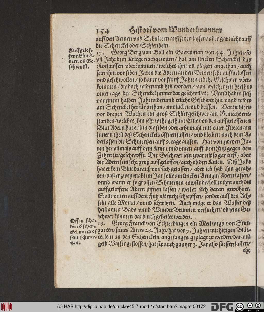 http://diglib.hab.de/drucke/45-7-med-1s/00172.jpg