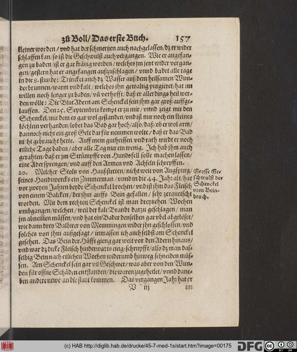 http://diglib.hab.de/drucke/45-7-med-1s/00175.jpg