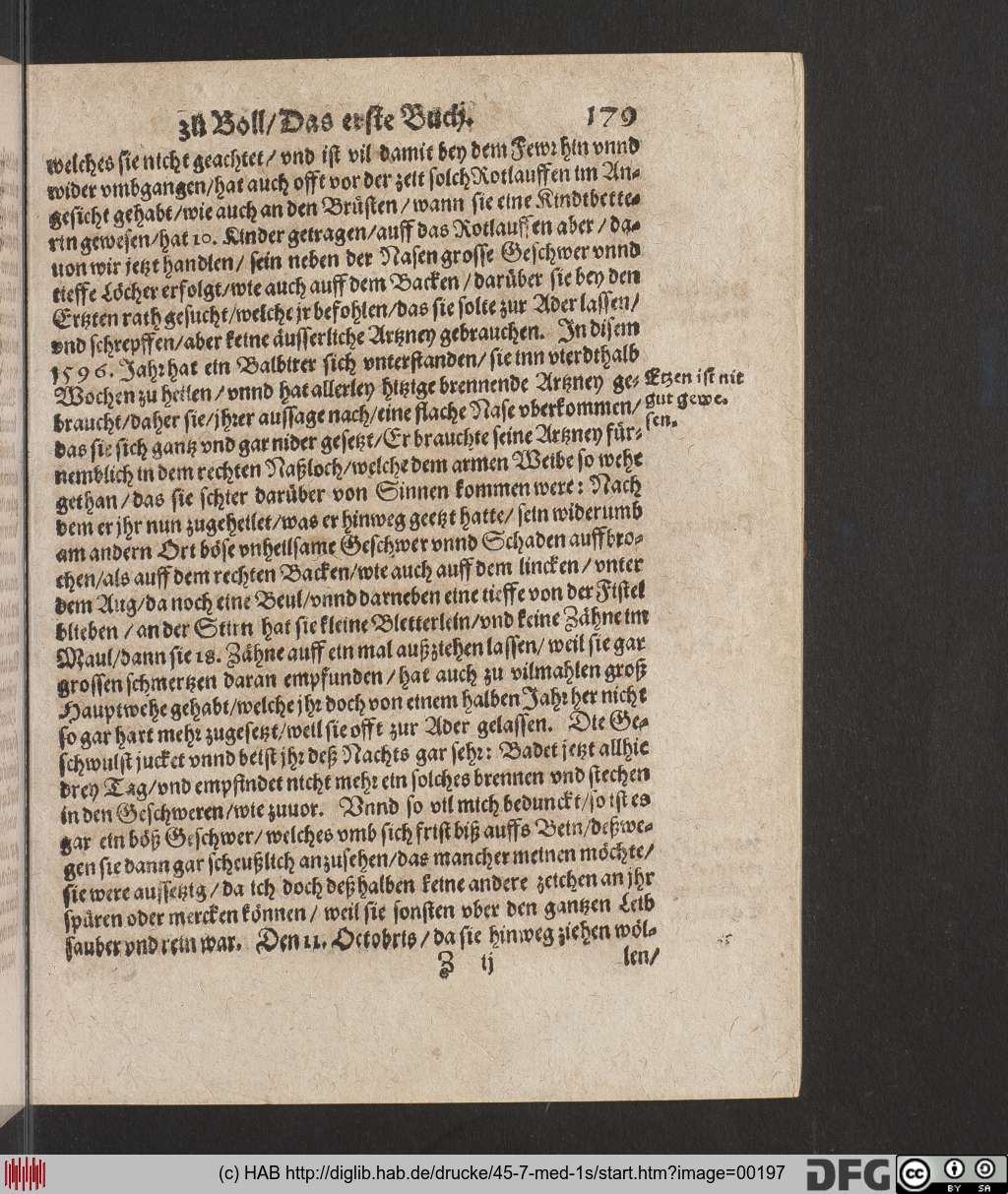 http://diglib.hab.de/drucke/45-7-med-1s/00197.jpg
