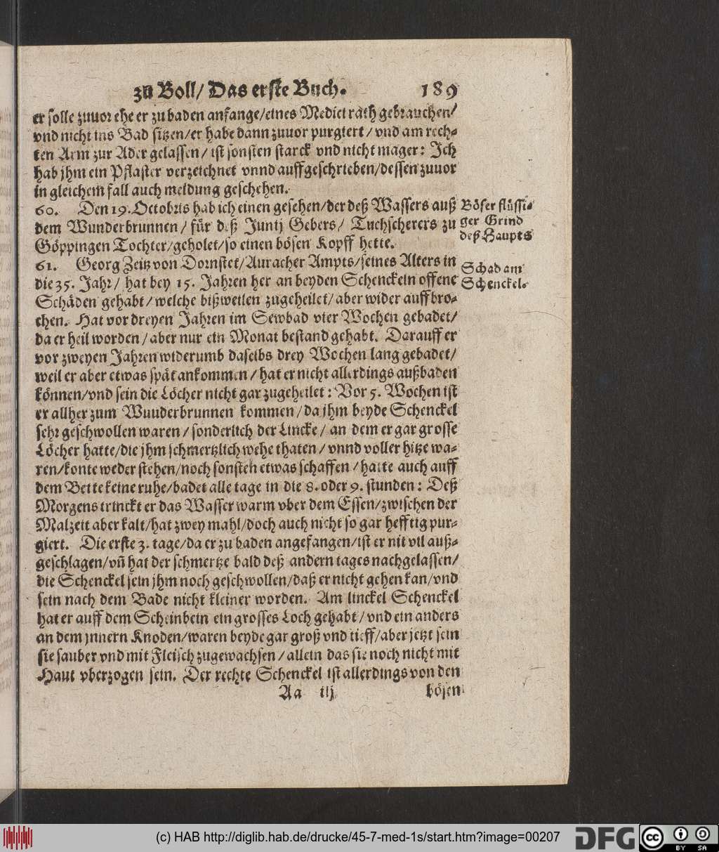 http://diglib.hab.de/drucke/45-7-med-1s/00207.jpg