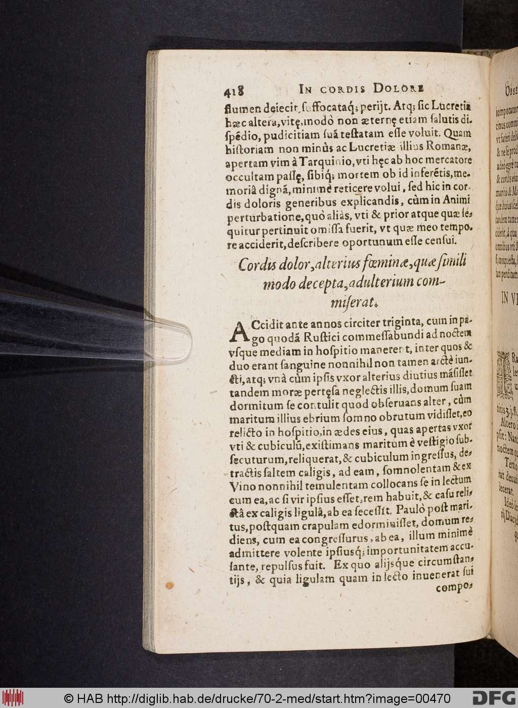 http://diglib.hab.de/drucke/70-2-med/00470.jpg