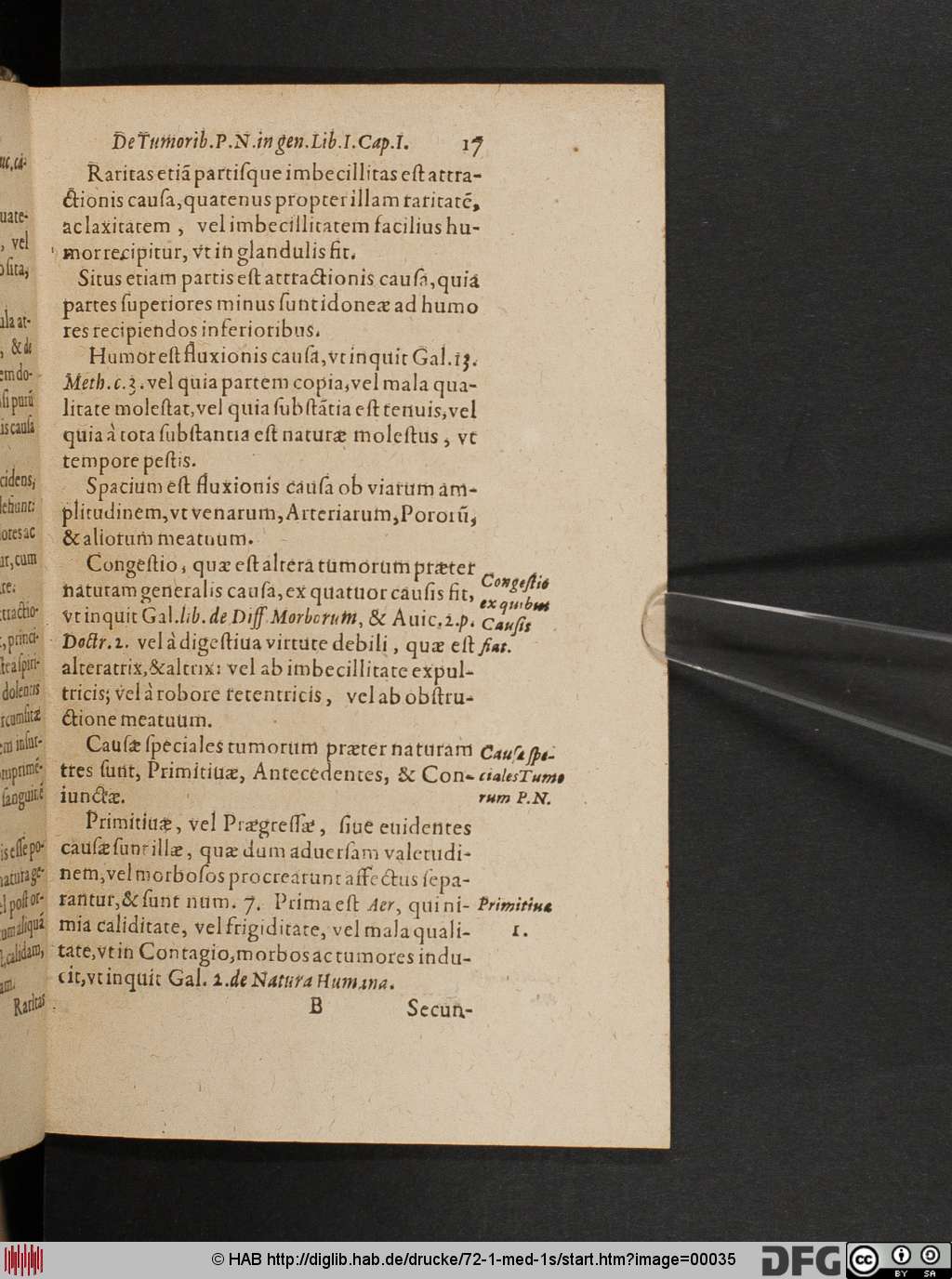 http://diglib.hab.de/drucke/72-1-med-1s/00035.jpg