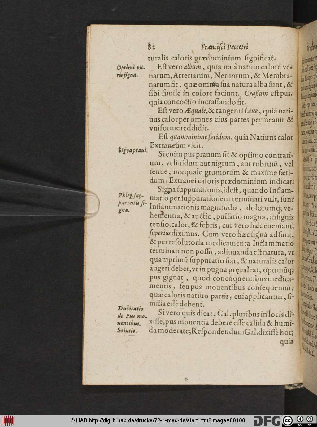 http://diglib.hab.de/drucke/72-1-med-1s/00100.jpg