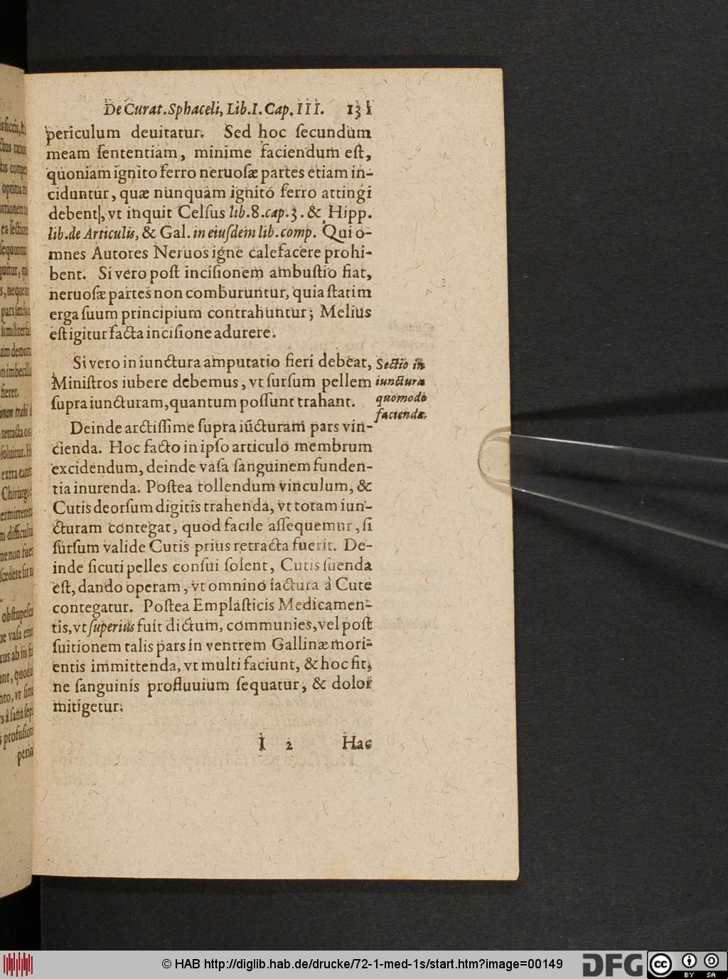 http://diglib.hab.de/drucke/72-1-med-1s/00149.jpg