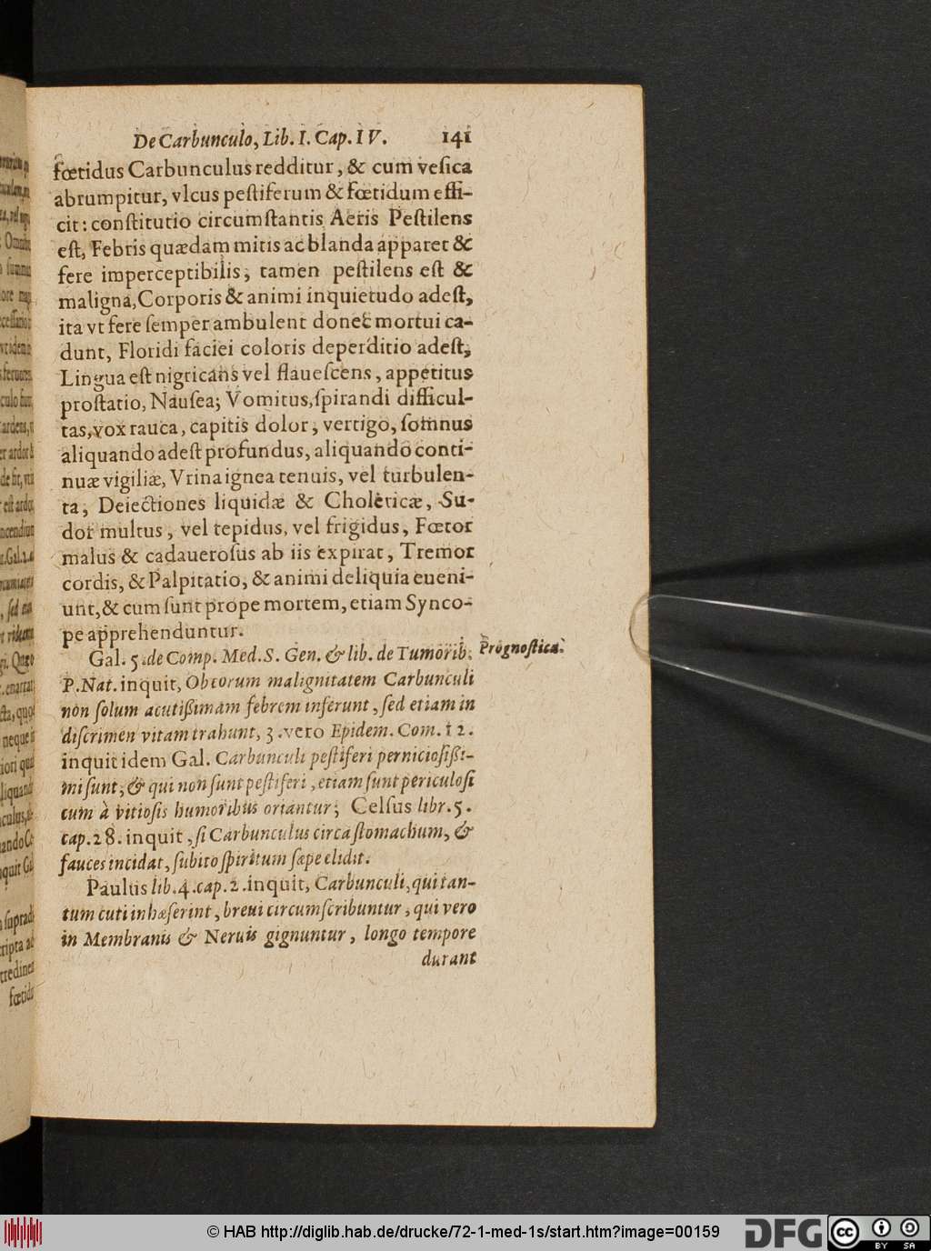 http://diglib.hab.de/drucke/72-1-med-1s/00159.jpg