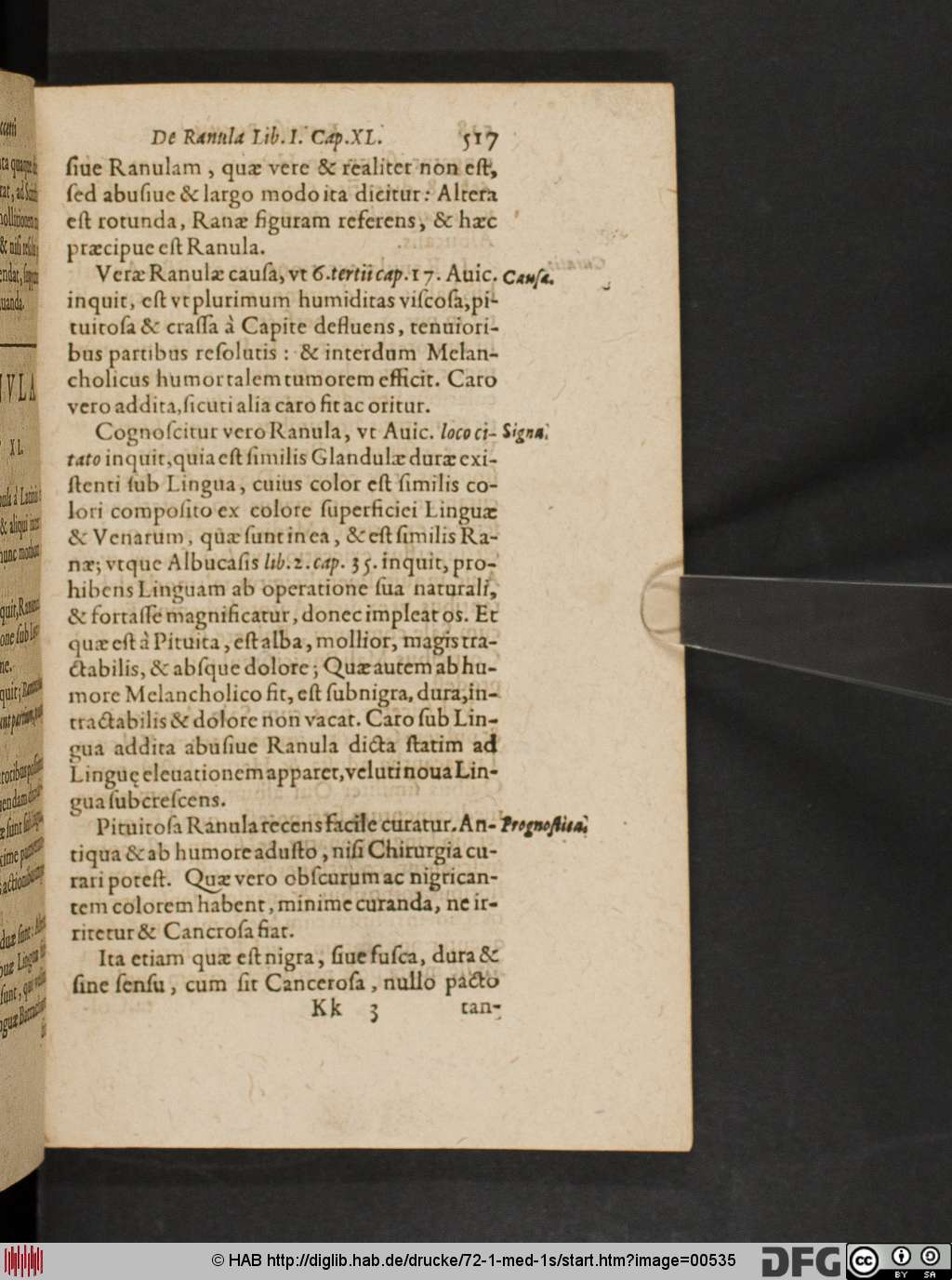 http://diglib.hab.de/drucke/72-1-med-1s/00535.jpg