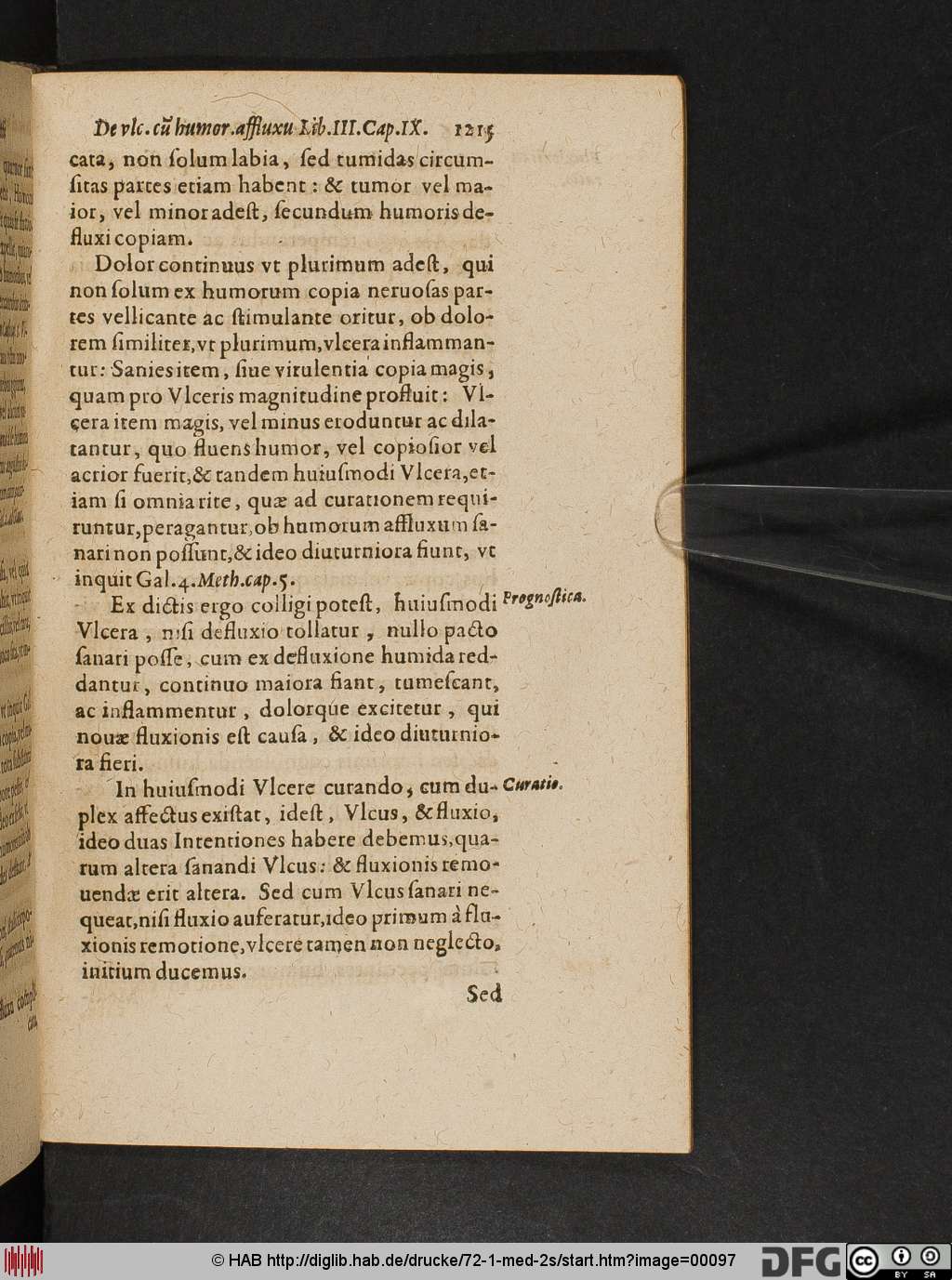 http://diglib.hab.de/drucke/72-1-med-2s/00097.jpg