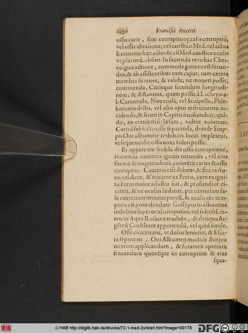 http://diglib.hab.de/drucke/72-1-med-2s/00178.jpg