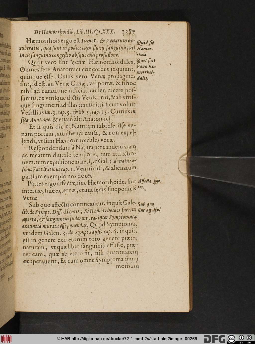 http://diglib.hab.de/drucke/72-1-med-2s/00269.jpg