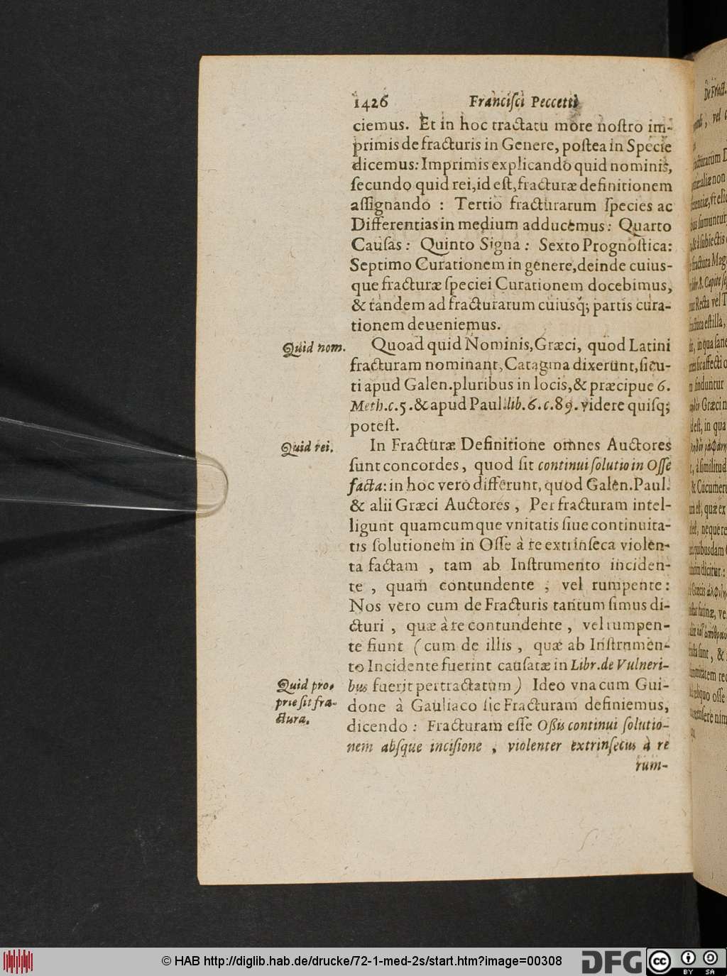 http://diglib.hab.de/drucke/72-1-med-2s/00308.jpg