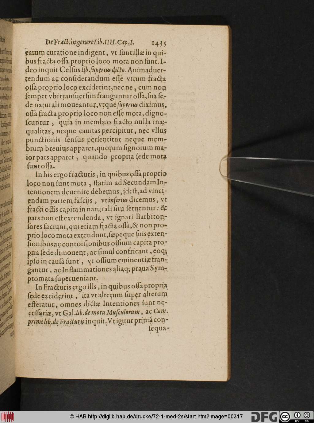 http://diglib.hab.de/drucke/72-1-med-2s/00317.jpg