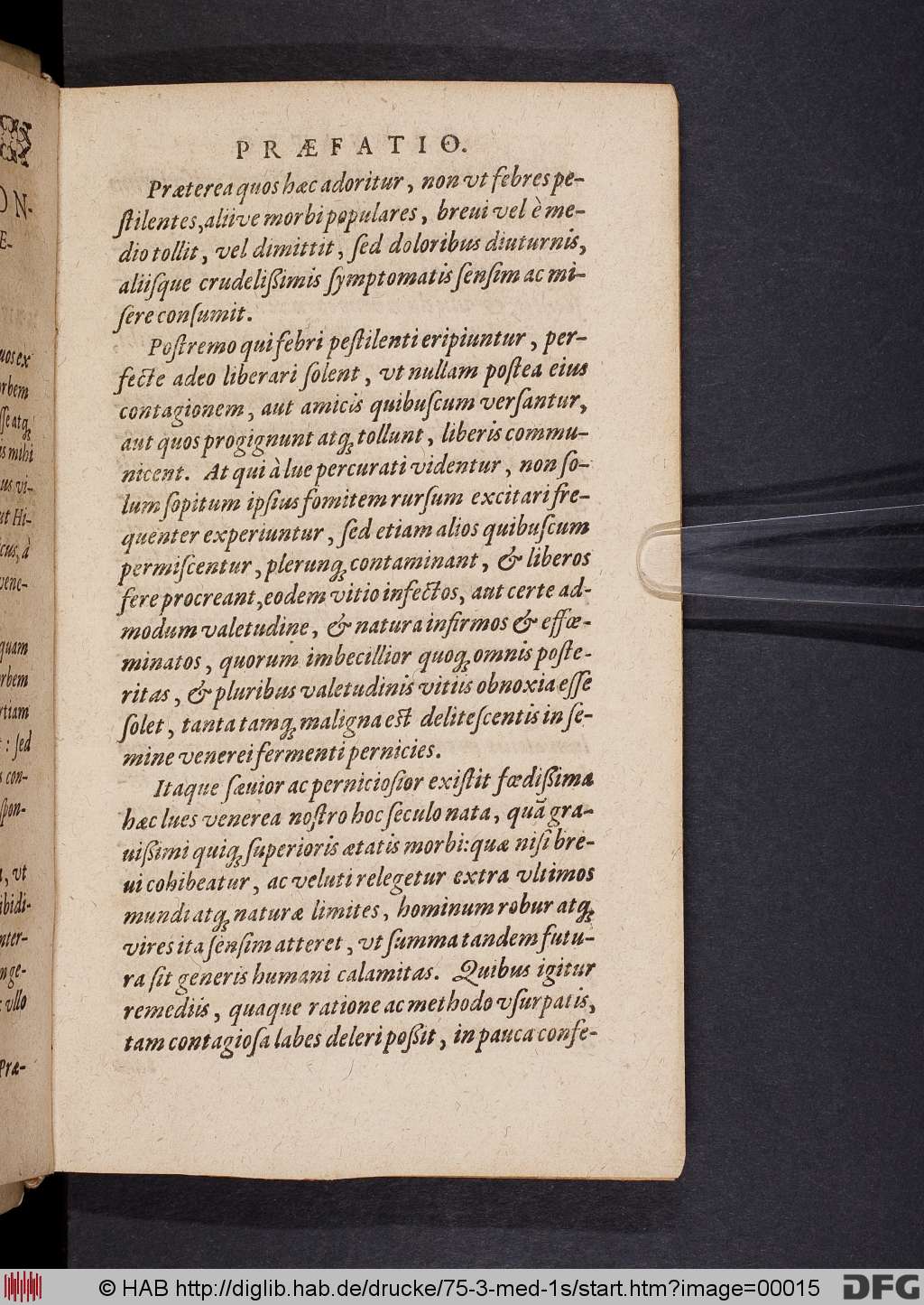http://diglib.hab.de/drucke/75-3-med-1s/00015.jpg