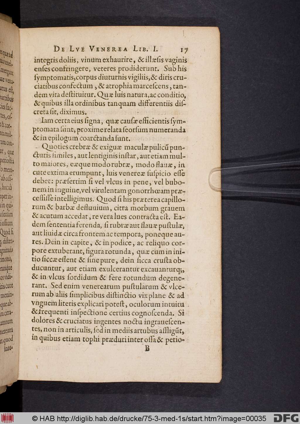 http://diglib.hab.de/drucke/75-3-med-1s/00035.jpg