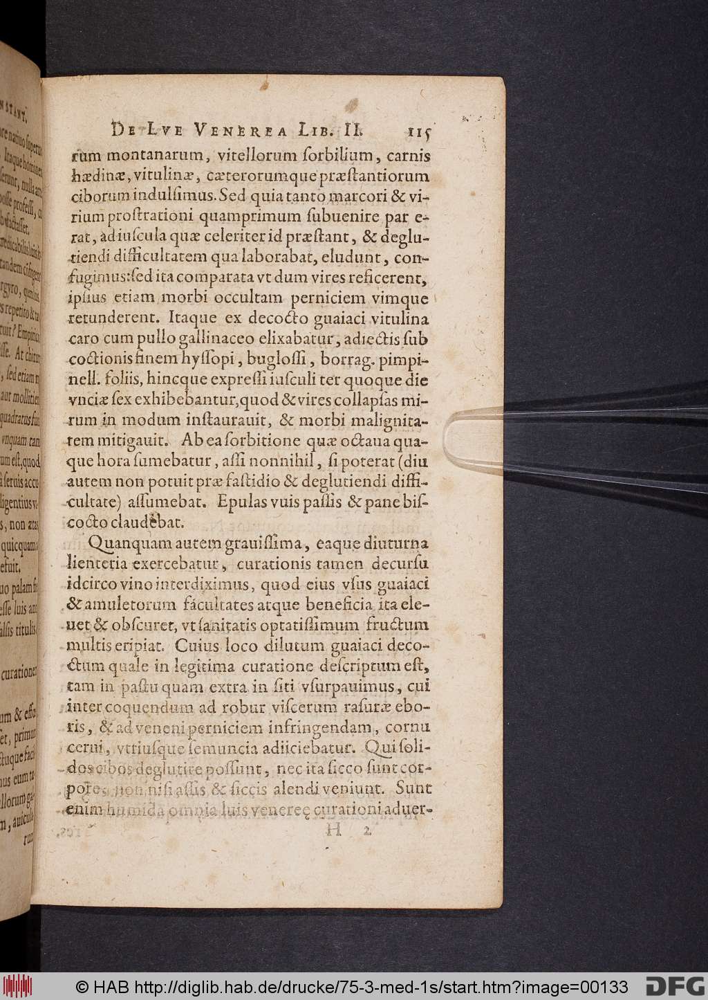 http://diglib.hab.de/drucke/75-3-med-1s/00133.jpg