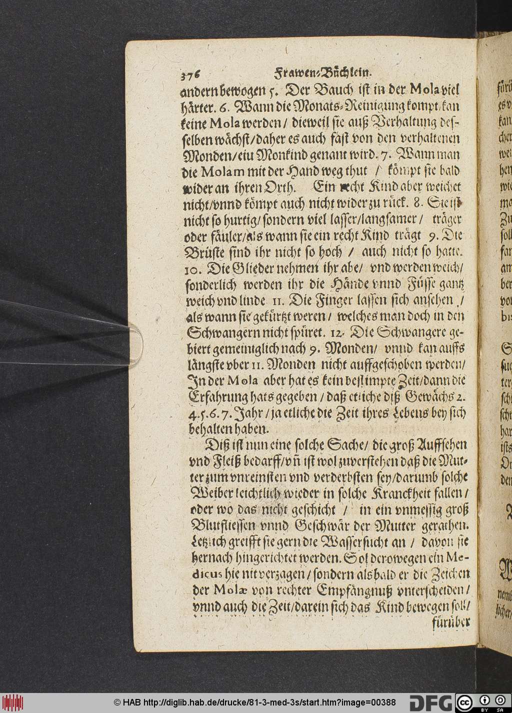 http://diglib.hab.de/drucke/81-3-med-3s/00388.jpg