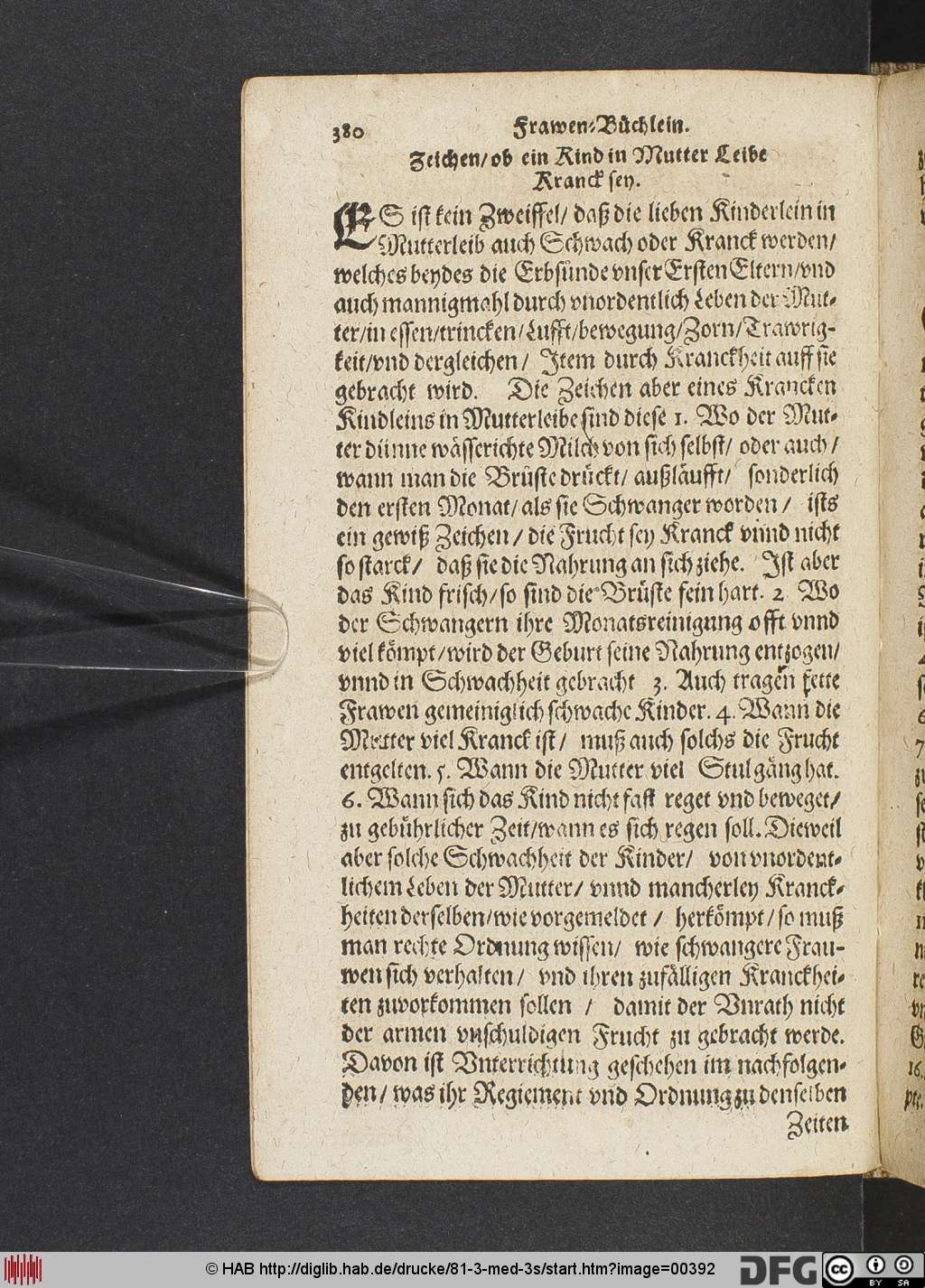 http://diglib.hab.de/drucke/81-3-med-3s/00392.jpg