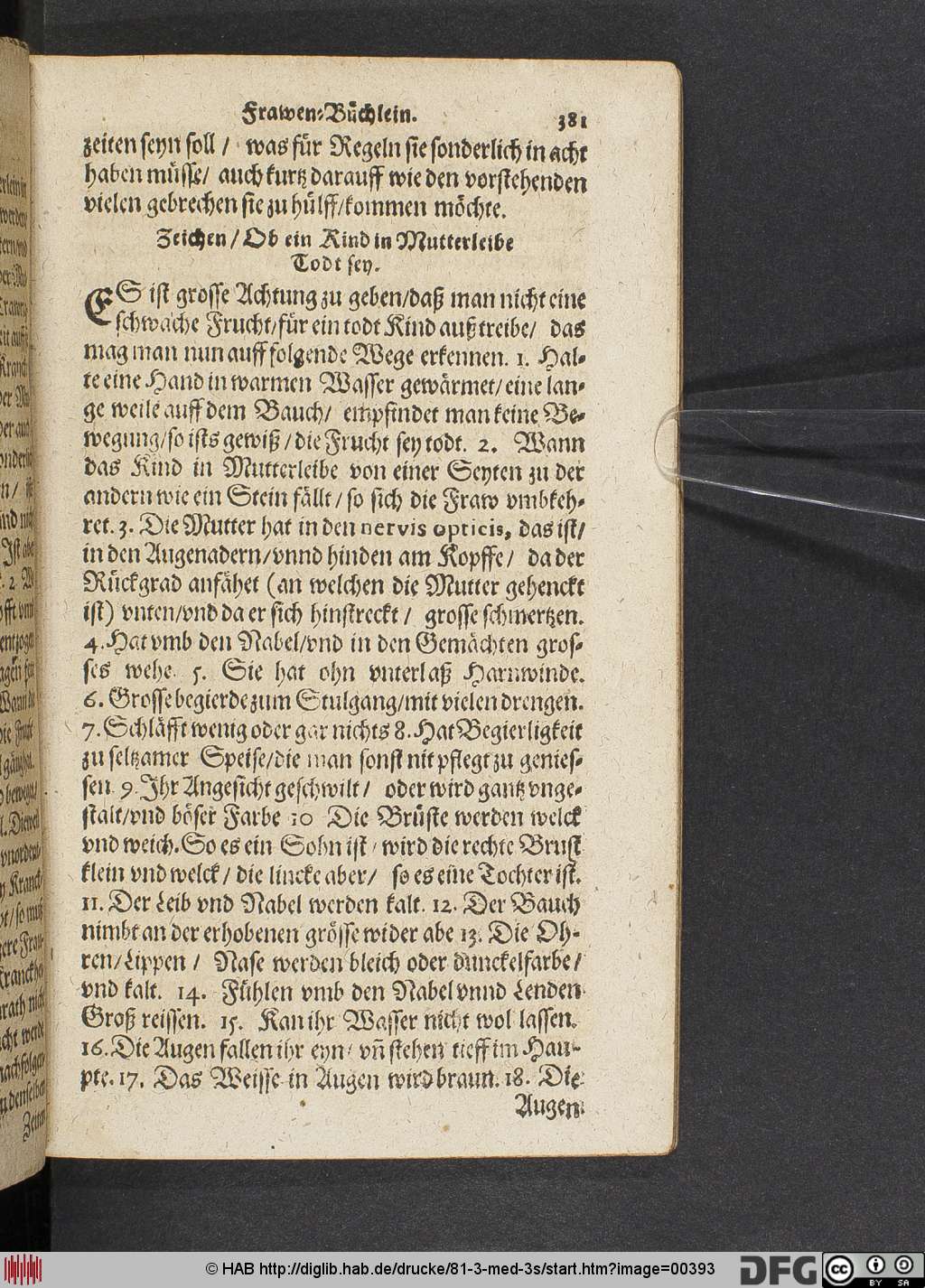 http://diglib.hab.de/drucke/81-3-med-3s/00393.jpg