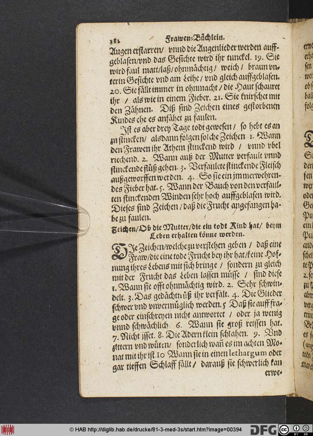 http://diglib.hab.de/drucke/81-3-med-3s/00394.jpg