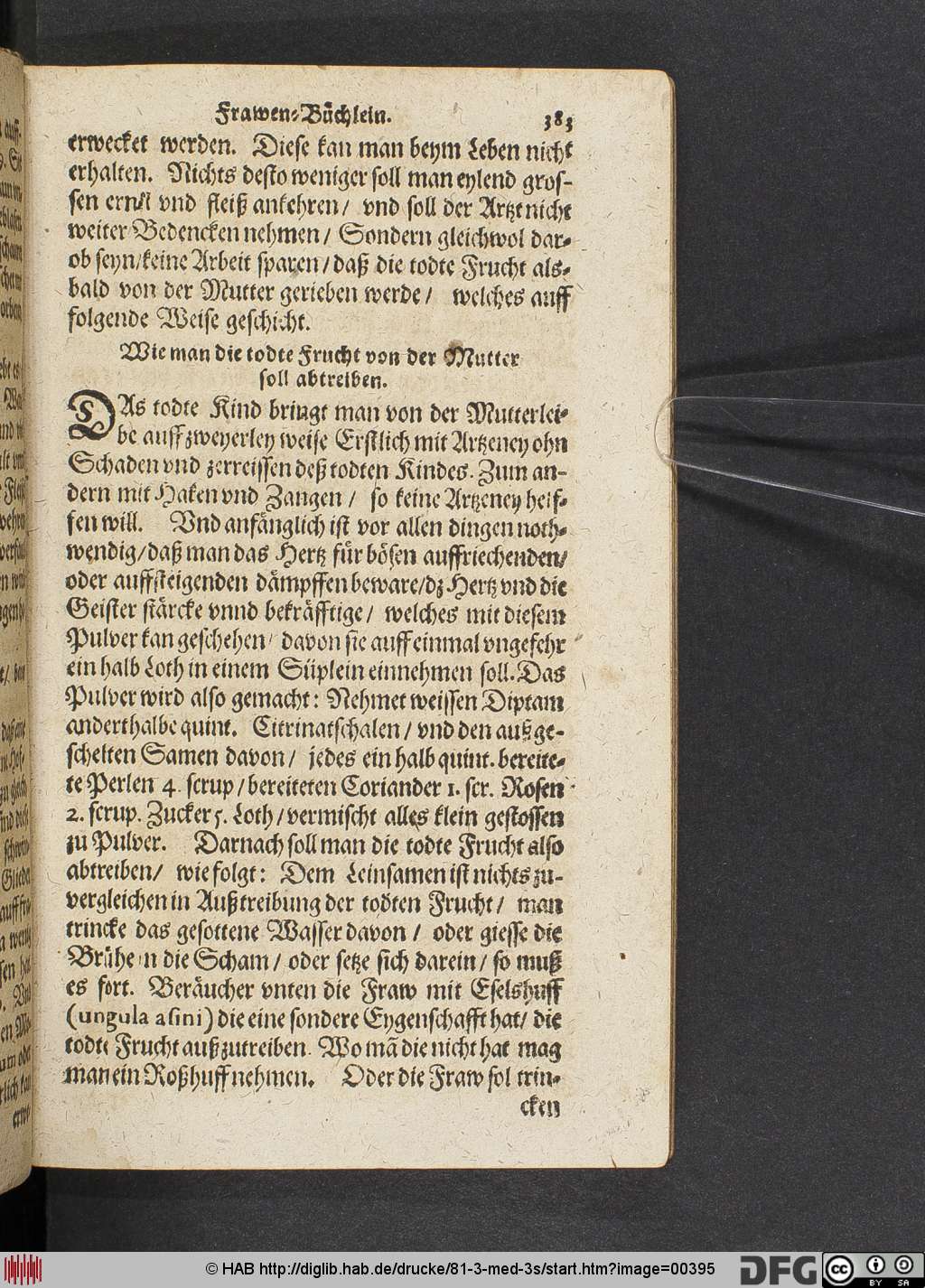 http://diglib.hab.de/drucke/81-3-med-3s/00395.jpg