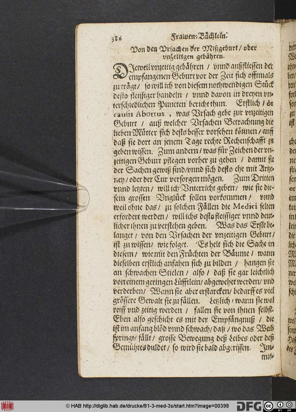 http://diglib.hab.de/drucke/81-3-med-3s/00398.jpg