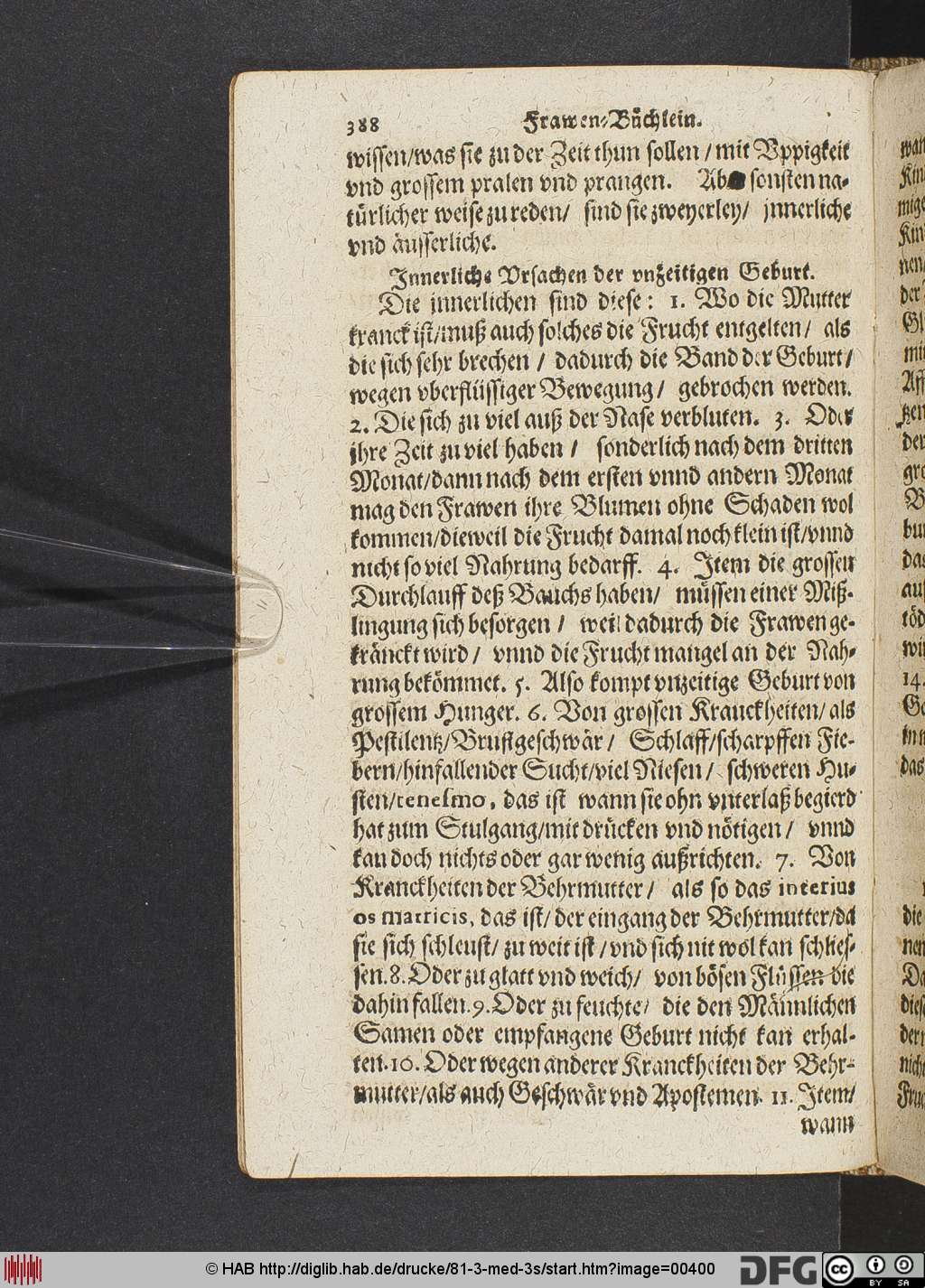 http://diglib.hab.de/drucke/81-3-med-3s/00400.jpg