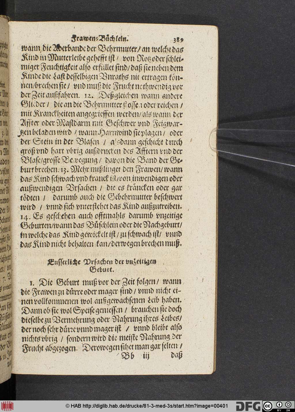 http://diglib.hab.de/drucke/81-3-med-3s/00401.jpg