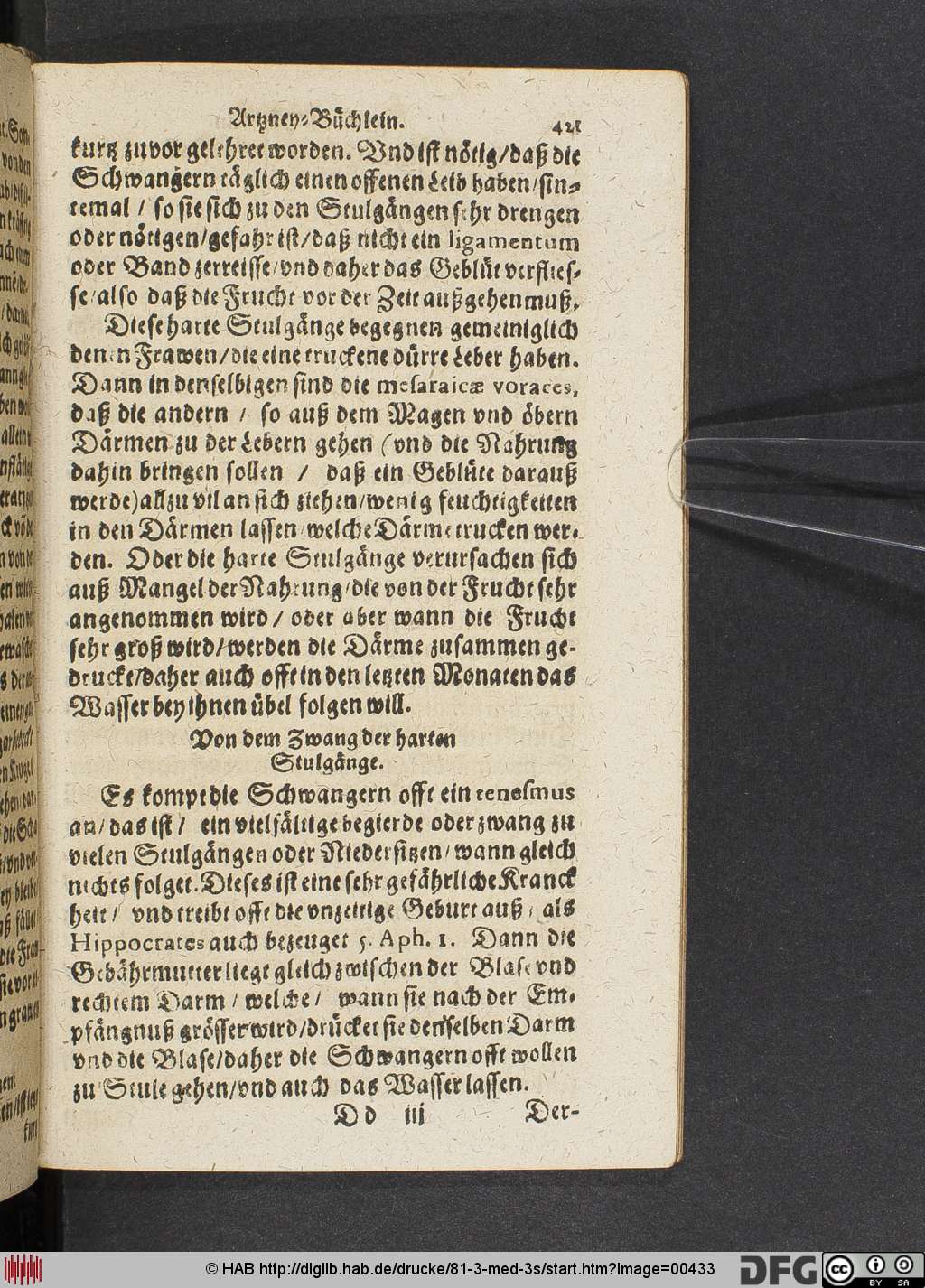 http://diglib.hab.de/drucke/81-3-med-3s/00433.jpg
