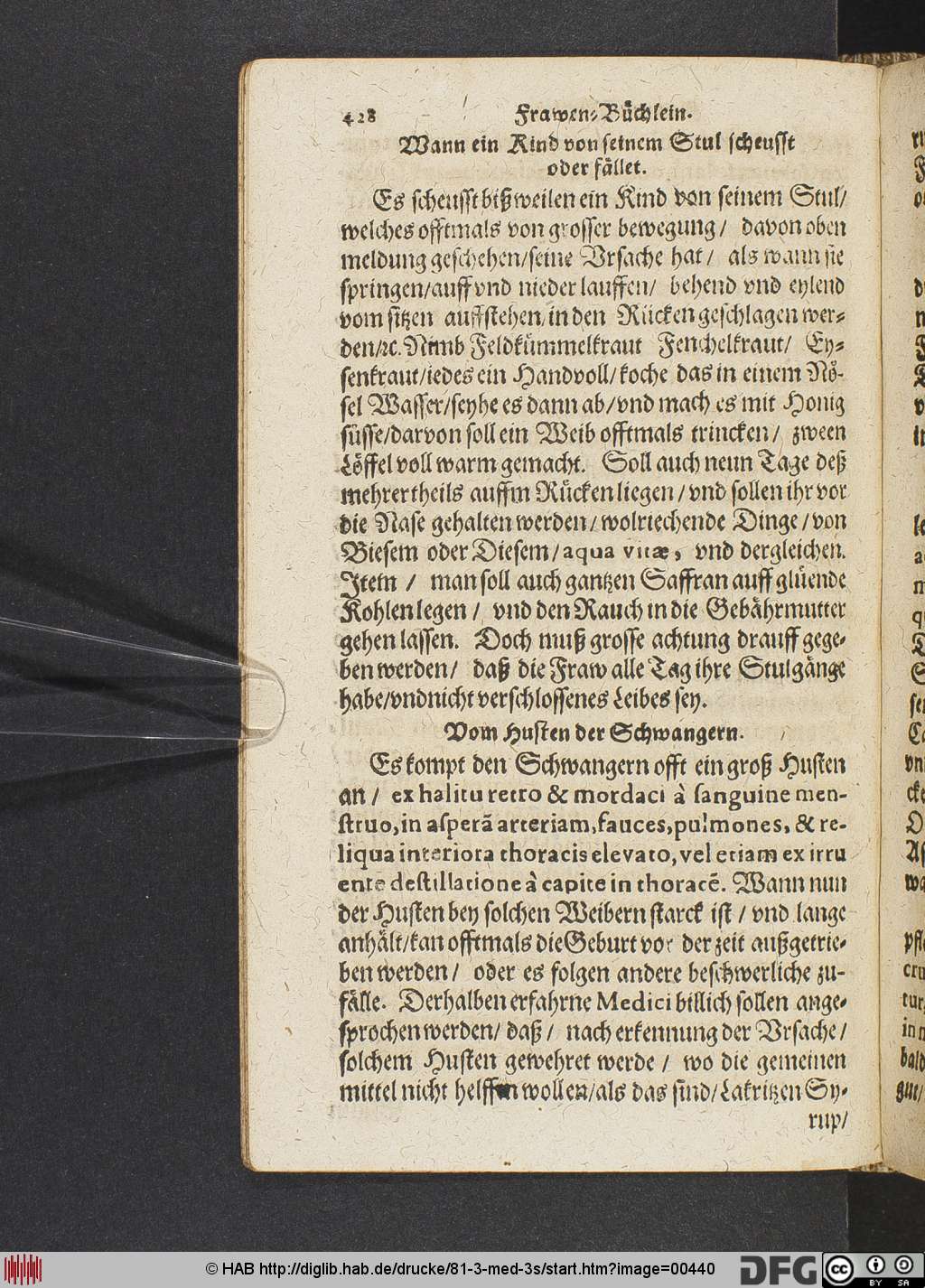 http://diglib.hab.de/drucke/81-3-med-3s/00440.jpg