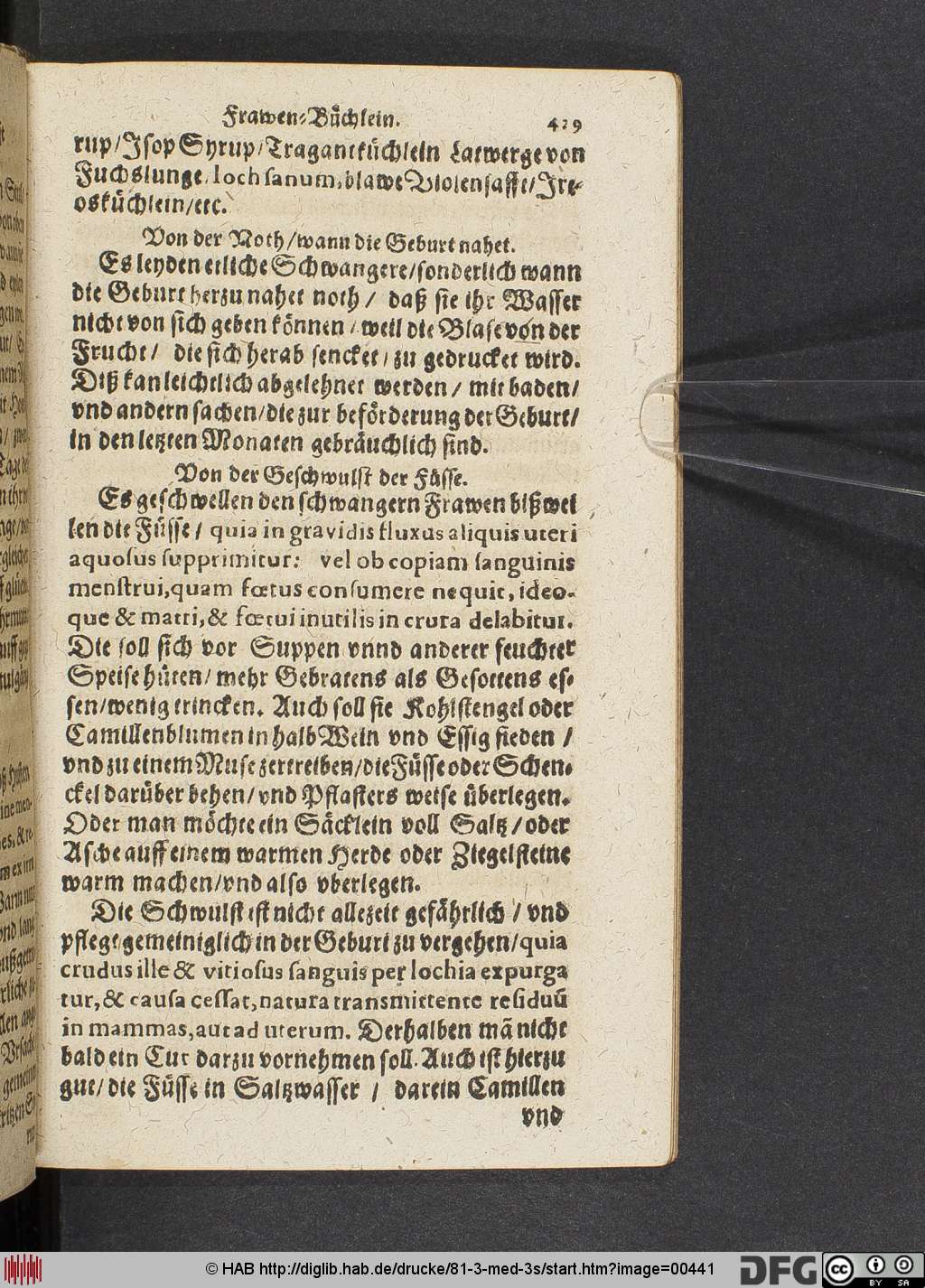 http://diglib.hab.de/drucke/81-3-med-3s/00441.jpg