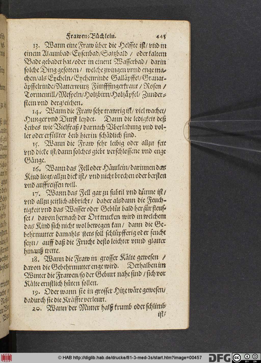 http://diglib.hab.de/drucke/81-3-med-3s/00457.jpg