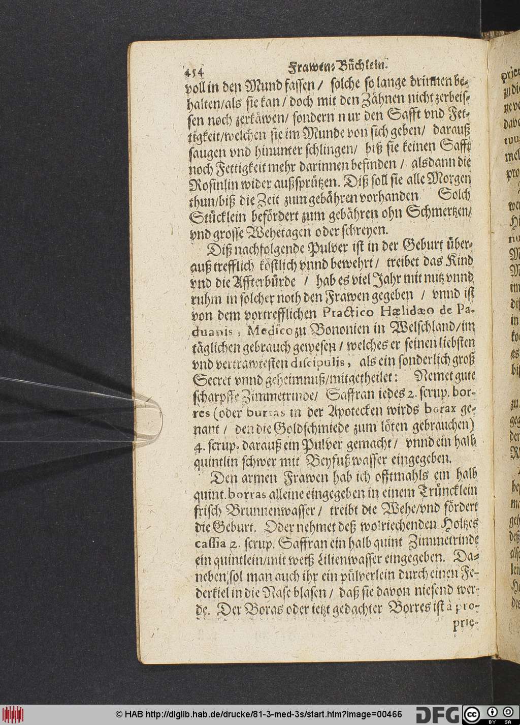 http://diglib.hab.de/drucke/81-3-med-3s/00466.jpg