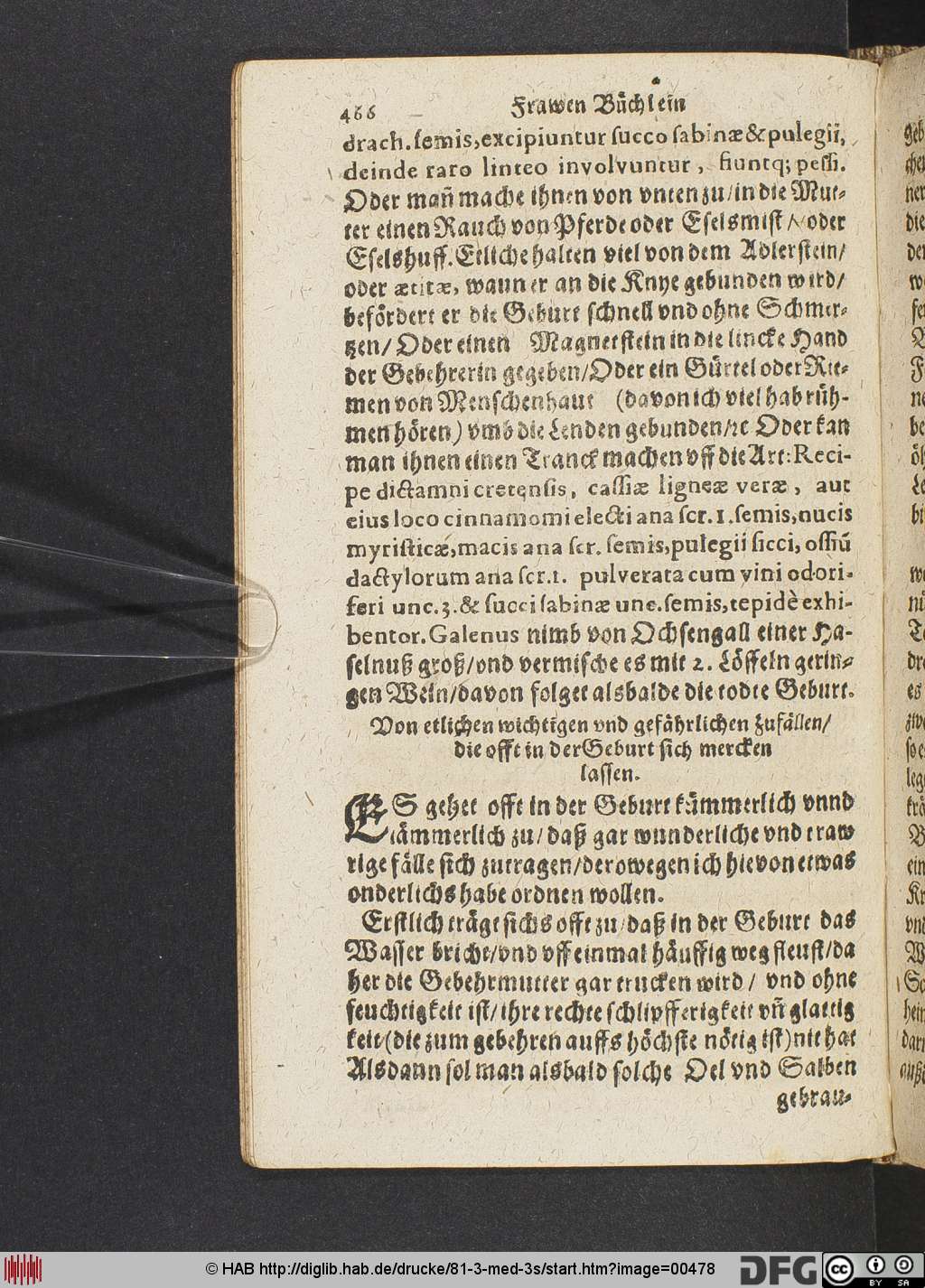 http://diglib.hab.de/drucke/81-3-med-3s/00478.jpg