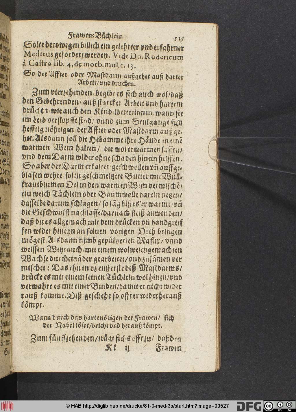 http://diglib.hab.de/drucke/81-3-med-3s/00527.jpg