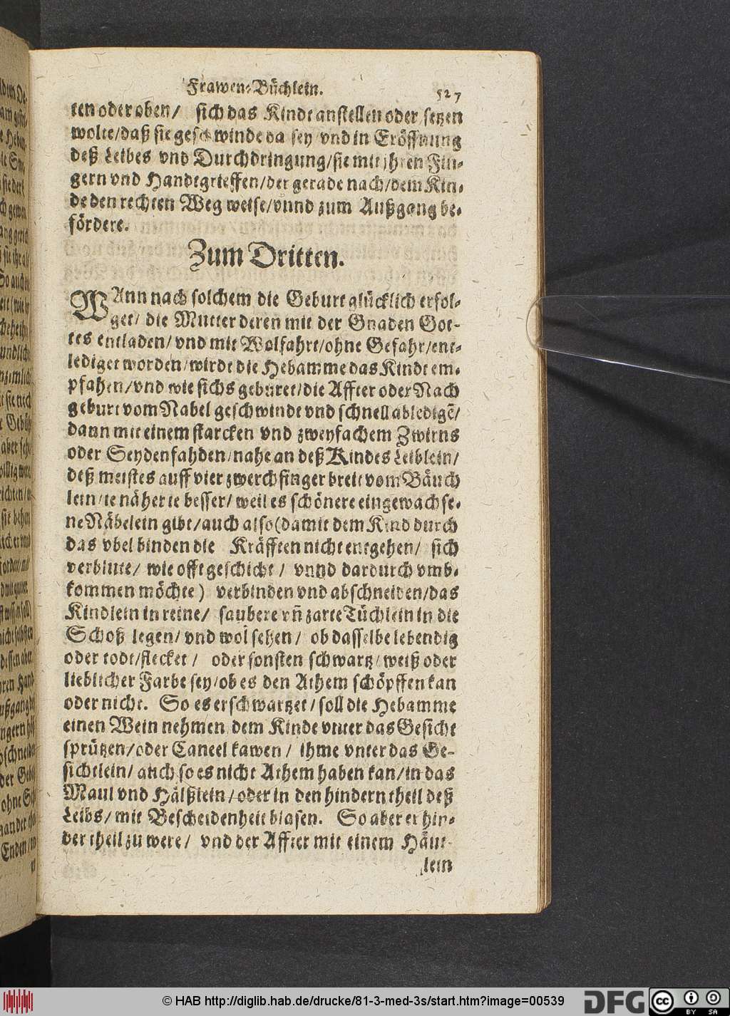 http://diglib.hab.de/drucke/81-3-med-3s/00539.jpg