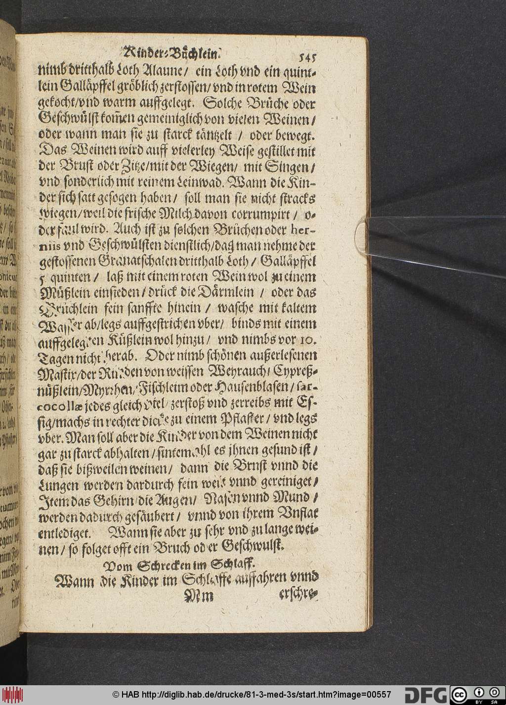 http://diglib.hab.de/drucke/81-3-med-3s/00557.jpg