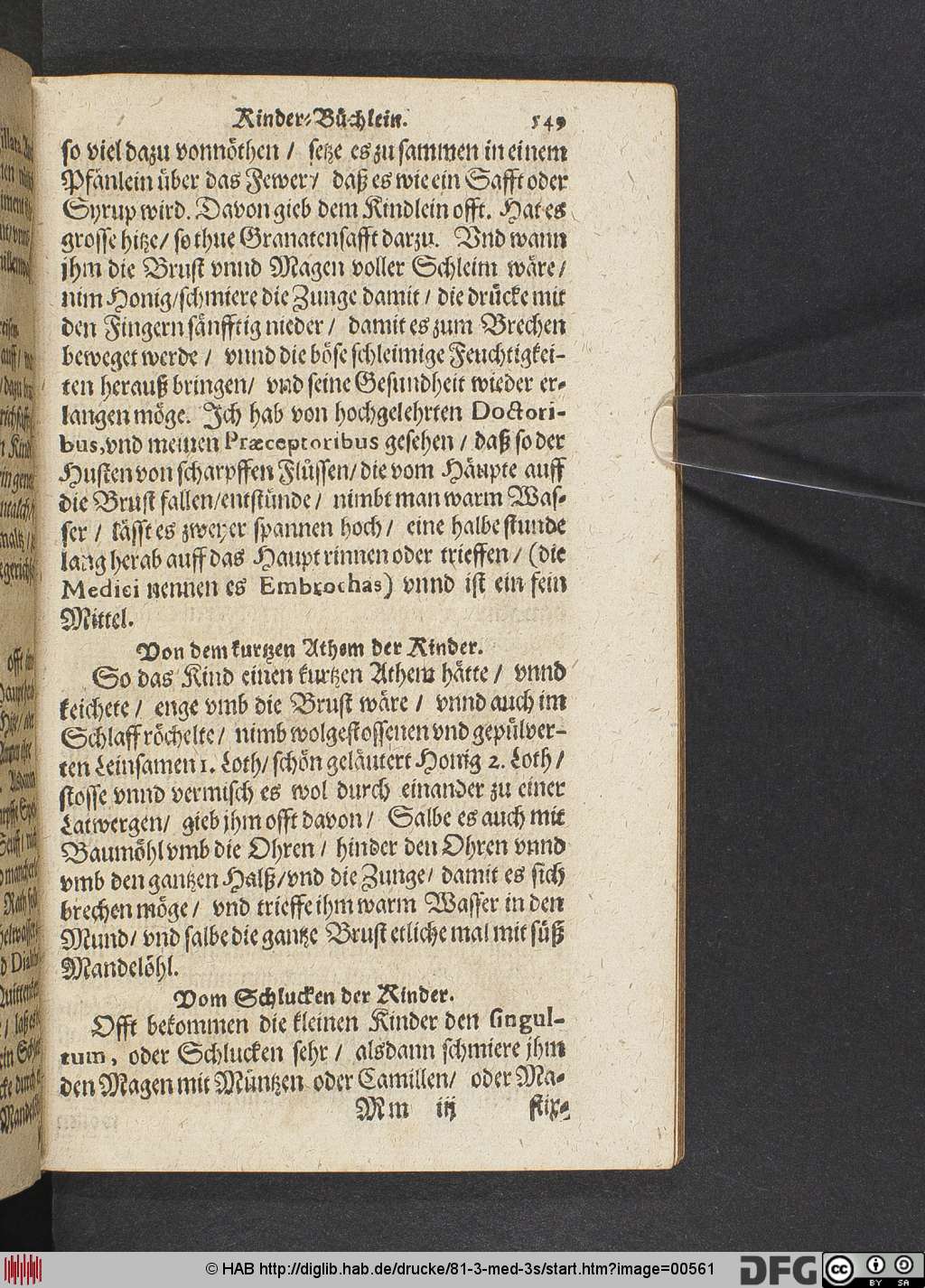 http://diglib.hab.de/drucke/81-3-med-3s/00561.jpg